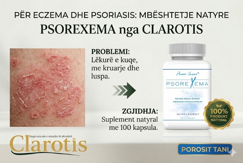 Capsules skin detox nga CLAROTIS, herbal eczema relief, psoriasis natural treatment, skin immune capsules, inflammation relief capsules, herbal skin balance, capsules for itching, skin recovery supplement, natural immunity detox